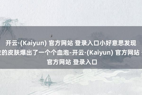 开云·(Kaiyun) 官方网站 登录入口小好意思发现打针部位的皮肤爆出了一个个血泡-开云·(Kaiyun) 官方网站 登录入口